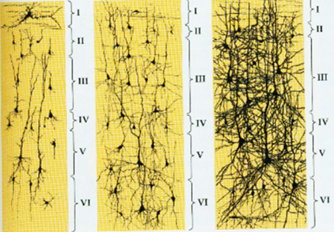 良医|只有一半大脑,他们为什么活得挺好?_腾讯新闻