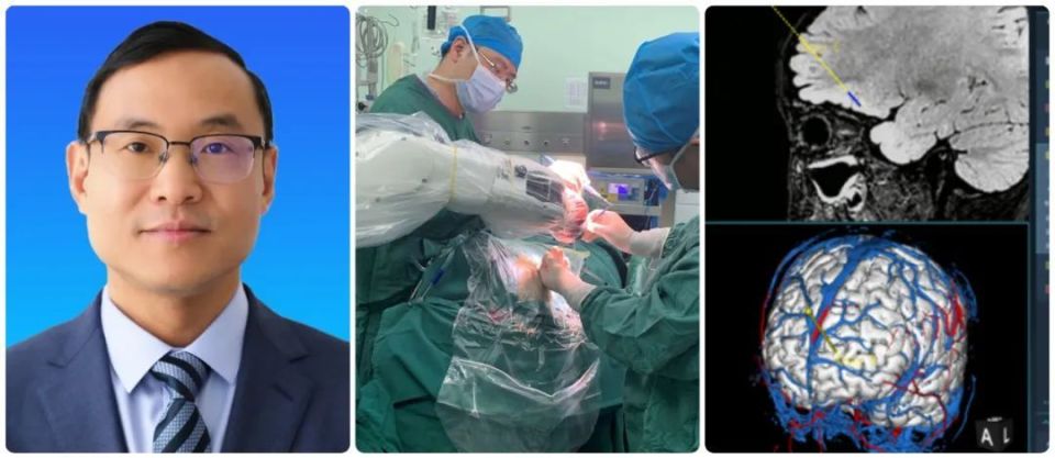 华科在线|专访中国科大附一院钱若兵:癫痫手术量年均200余例 有效率70