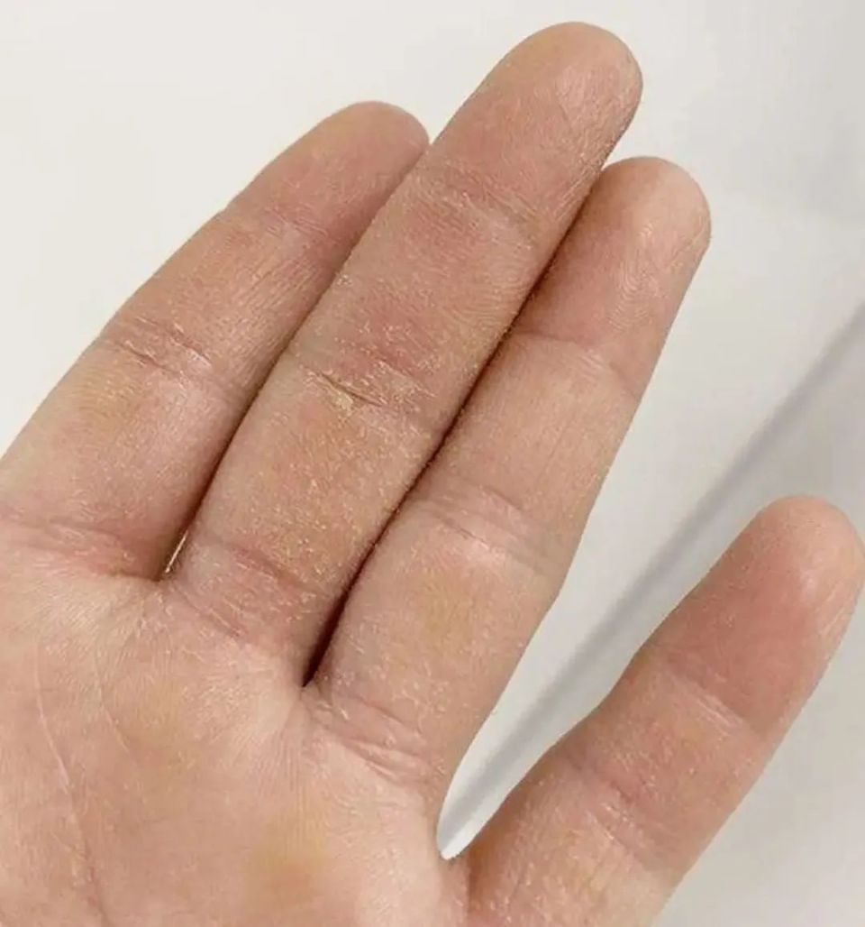 好用不伤手的洗洁精!去污去油无残留,味道还好闻