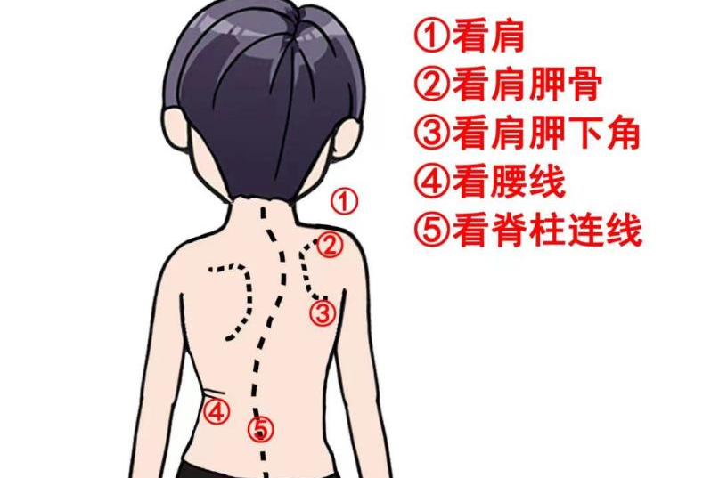 健康讲堂丨脊柱侧弯的知识，看这篇就够了！_腾讯新闻