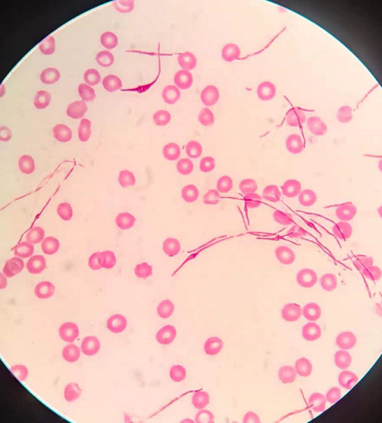 婀娜多姿的细菌竟然是它!_腾讯新闻