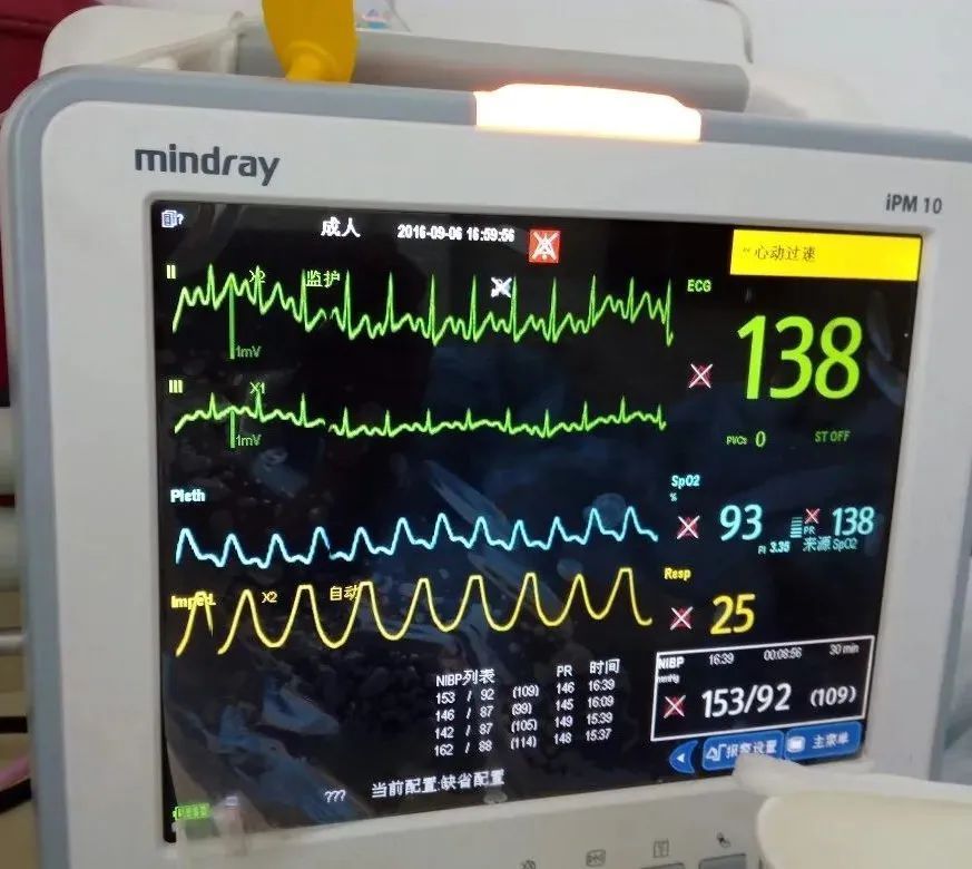 正常情况下人体动脉血氧饱和度在98%,静脉血氧饱和度在75%,血氧饱和度