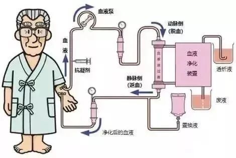 一文剖析血透血滤灌流到底有什么区别