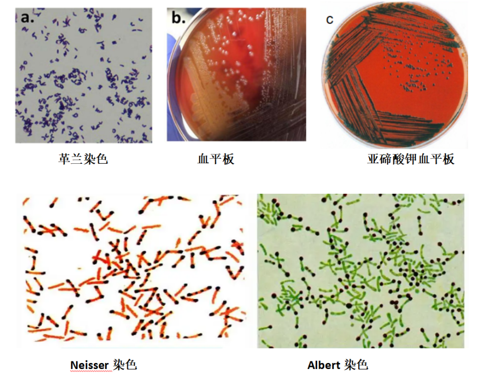 “重识”白喉棒状杆菌_腾讯新闻