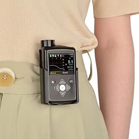 最新,美敦力自适应胰岛素泵获批fda