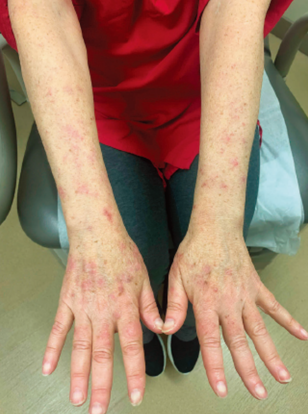 这种乳腺癌患者化疗后的不良反应很少见……_腾讯新闻