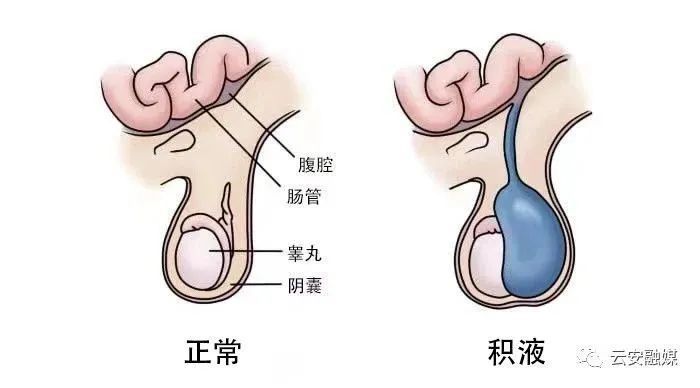 鞘膜的壁层,贴于阴囊内侧;鞘层的脏层,则覆盖于睾丸何附睾的表面.