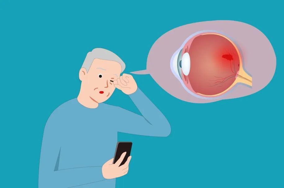 百姓健康什么是糖尿病眼底病变带你了解