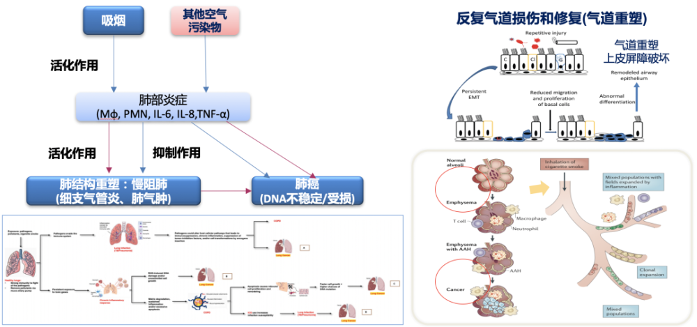 陳良安教授:肺癌與慢阻肺病的發病機制,臨床特徵如何?