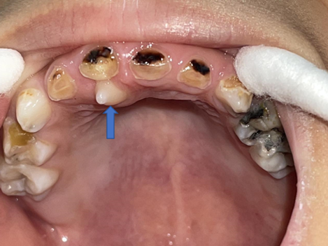 "多生牙",你有听说过吗?