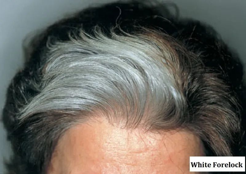 深圳一副区长前额的一簇白发引关注,"挑染"还是天生?