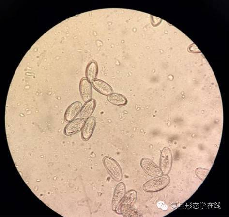 100 x)图2:高倍视野(400x)图1:虫体涂片 (1x)形态学检查如下:粪便常规