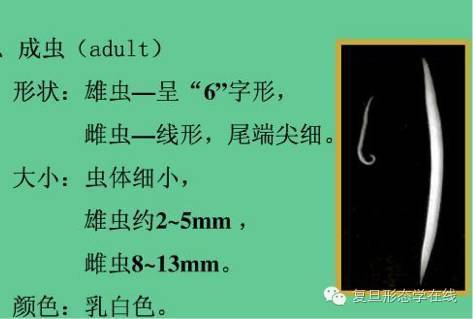 一例儿童蛲虫病的典型案例_腾讯新闻