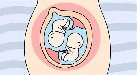 松江双胎孕妈双胎妊娠并发症你知道吗健康智慧屋