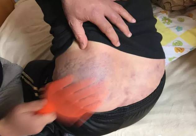 妇科|气血|腰骶部|妇科疾病|宫寒