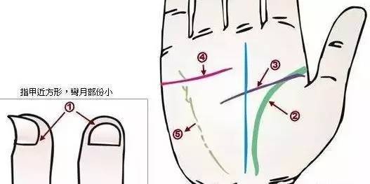 空腹時(飯後經一小時以上),胸有灼燒感,上腹陣陣鈍痛,如果吃點東西,能