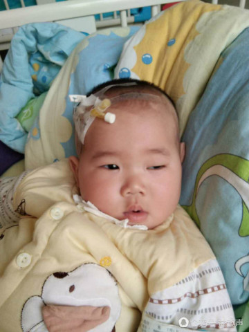 一岁脑膜炎宝抗战病魔6月余 奈何没有康复费用