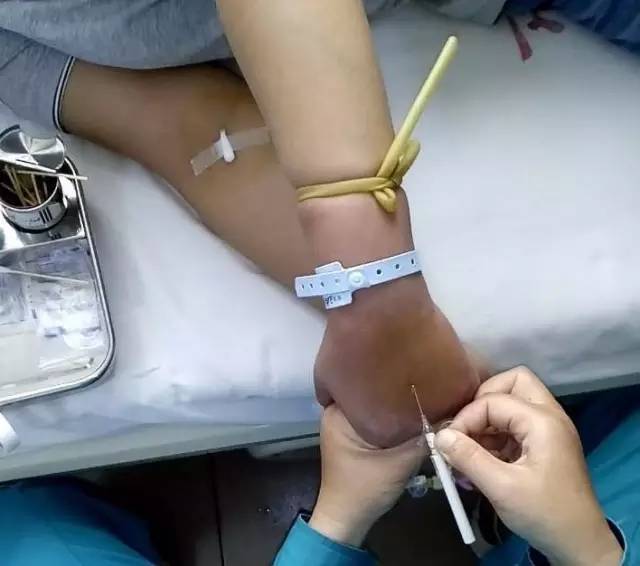 觉着进针长度可以了,准备撤针芯了,你的左手再腾出来固定套管针,同时