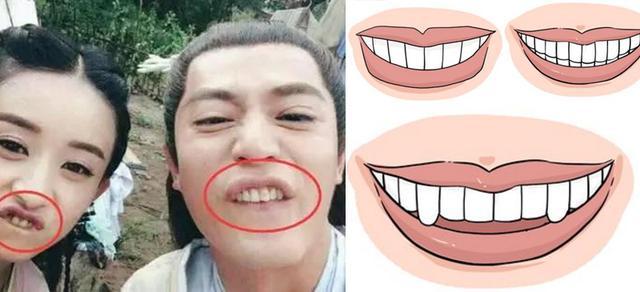 这4种牙齿的男女最好运,一生富裕,大贵特贵|面相