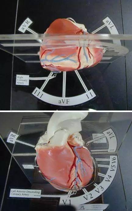心血管疾病|心血管疾病图文详解！太珍贵了！看完全明白！