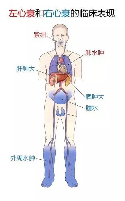 心血管疾病|心血管疾病图文详解！太珍贵了！看完全明白！