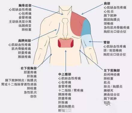 心血管疾病|心血管疾病图文详解！太珍贵了！看完全明白！