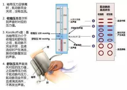 心血管疾病|心血管疾病图文详解！太珍贵了！看完全明白！