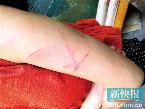 女子麻将桌上赌气输钱拒付 遭牌友持刀殴打手臂受伤