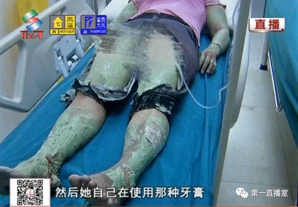 广东"绿巨人"被送进医院 医生吓一跳