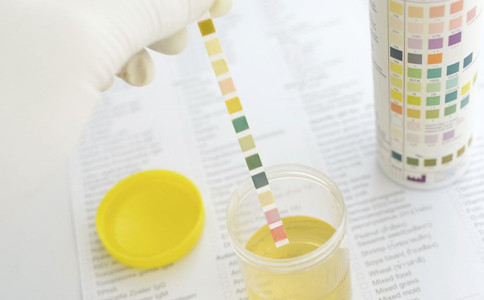 化验单|怎样看尿常规化验单？