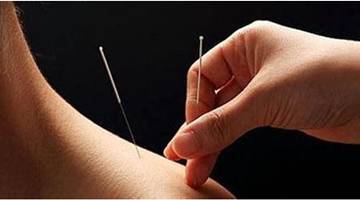 针刺手法针灸医师必看