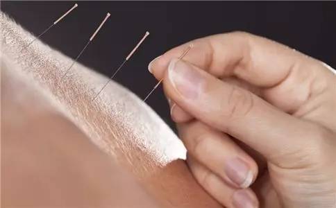 针刺手法针灸医师必看