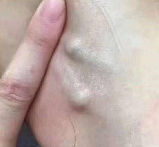 淋巴是女人的半条命!_腾讯新闻