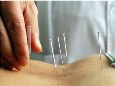 治疗腰痛八法及病案举例|针灸|腰椎骨质增生|流行性出血热|下肢