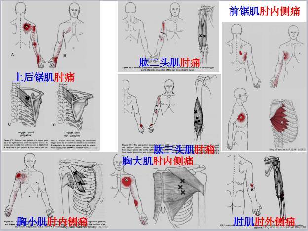 全身激痛點手冊