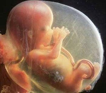 36周胎儿真人图片