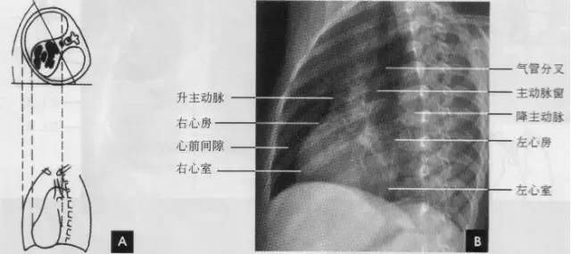 臨床乾貨詳細的胸部x線解剖最基礎最實用