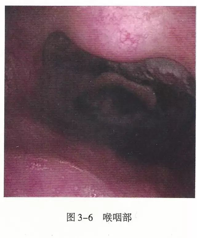 必备,上呼吸道解剖详解