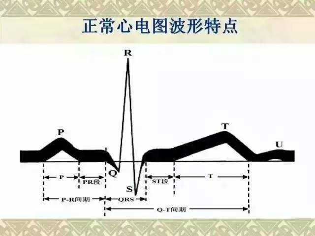 心電圖經典圖譜建議收藏