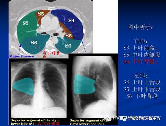 動脈弓上層面胸骨切跡層面縱膈窗右基底支氣管層面右中葉支氣管層面左