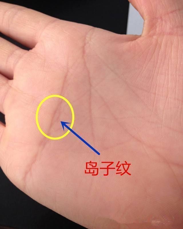 手相 手有岛子纹 倒霉之兆 不论哪条线 皆不好 无福还有灾
