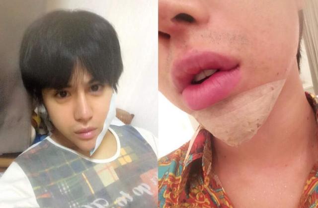 变态男疯狂整容变"蛇精"