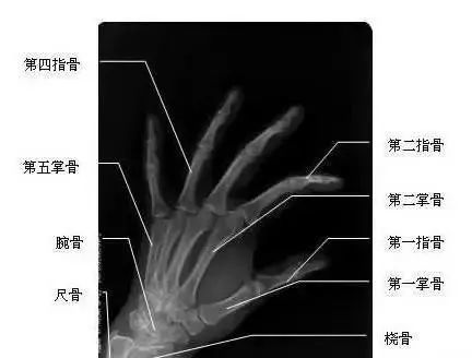 那就是——腱鞘炎它们其实都是一种疾病的别称「手机手」,「键盘手」