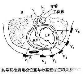 v3r～v6r:v3～v6的右側對稱處(用於小兒右心病變)v9:左脊旁線與v4水平