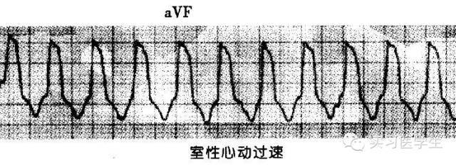 心電圖零基礎到有序閱讀