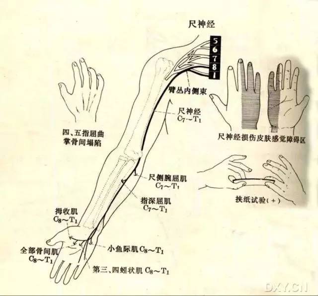 五个引起尺神经卡压的点 腾讯新闻