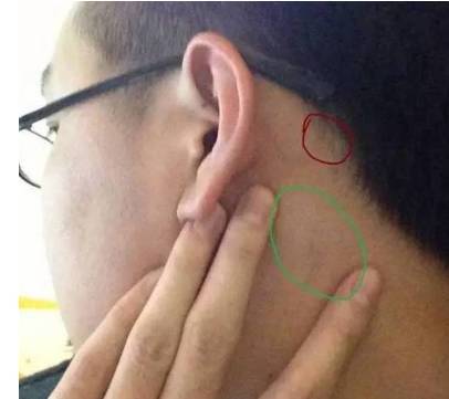 腮腺|淋巴按摩|腋下|淋巴结|淋巴|淋巴液