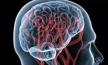 脑供血不足患者案例脑供血不足导致记忆力减退王炳彦院长四联疗法治疗