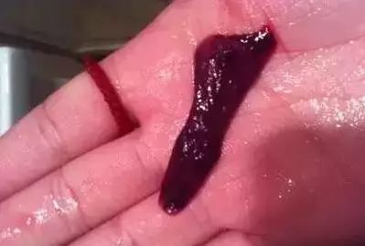 血块|经期|痛经|黑色血块|月经