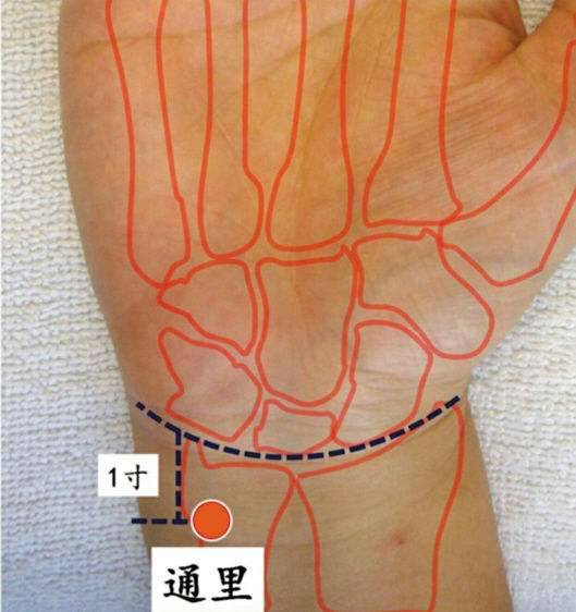 2,穴名:少海(手少陰心經,合穴)手法:連續不斷掐按1-2分